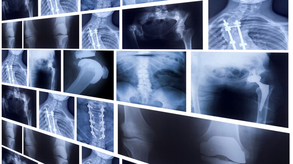 X-ray machines, gamma cameras, and nuclear medicine systems